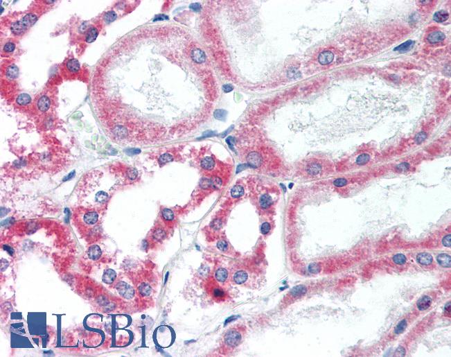 Anti-HSD11B2 antibody IHC of human kidney. Immunohistochemistry of formalin-fixed, paraffin-embedded tissue after heat-induced antigen retrieval. Antibody LS-B2135 concentration 10 ug/ml.