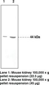 Western blot of HSD2 / HSD11B2 antibody LS-C150690.