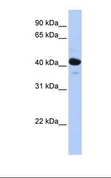 Fetal muscle lysate. Antibody concentration: 1.0 ug/ml. Gel concentration: 12%.