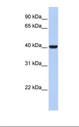Placenta lysate. Antibody concentration: 1.0 ug/ml. Gel concentration: 12%.