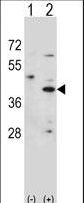Western blot of HSD3B1 (arrow) using rabbit polyclonal HSD3B1 Antibody. 293 cell lysates (2 ug/lane) either nontransfected (Lane 1) or transiently transfected (Lane 2) with the HSD3B1 gene.