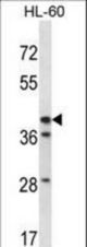HSD3B1 Antibody western blot of HL-60 cell line lysates (35 ug/lane). The HSD3B1 antibody detected the HSD3B1 protein (arrow).