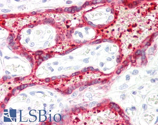 Anti-HSD3B1 antibody IHC staining of human placenta. Immunohistochemistry of formalin-fixed, paraffin-embedded tissue after heat-induced antigen retrieval.