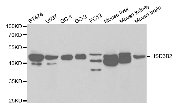 Western blot analysis of extracts of various cell lines, using HSD3B2 antibody.