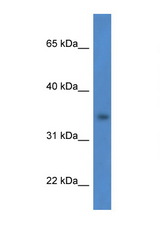 HSDL1 antibody LS-C135842 Western blot of HCT15 Cell lysate. Antibody concentration 1 ug/ml.