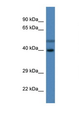 HSDL1 antibody LS-C135843 Western blot of Fetal Liver lysate. Antibody concentration 1 ug/ml.