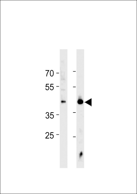 HSF1 Antibody western blot of Jurkat cell line and mouse heart tissue lysates (35 ug/lane). The HSF1 antibody detected the HSF1 protein (arrow).