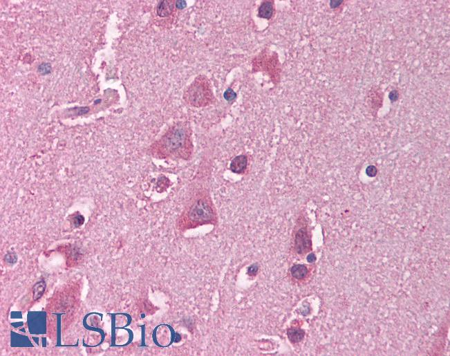 Anti-HSF1 antibody IHC of human brain, cortex. Immunohistochemistry of formalin-fixed, paraffin-embedded tissue after heat-induced antigen retrieval. Antibody LS-B1539 concentration 5 ug/ml.