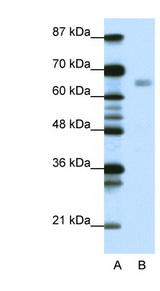 HSF1 antibody LS-B1539 Western blot of Jurkat lysate.