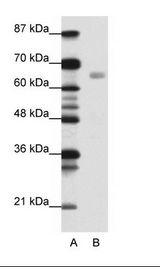 A: Marker, B: Jurkat Cell Lysate