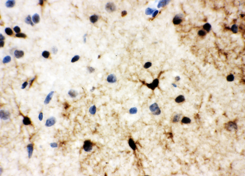 HSF2 antibody. IHC(P): Rat Brain Tissue.