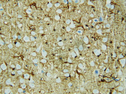 HSF2 antibody. IHC(P): Rat Brain Tissue.