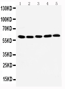 WB of HSF2 antibody. All lanes: Anti-HSF2 at 0.5ug/ml. Lane 1: Rat Kidney Tissue Lysate at 40ug. Lane 2: Rat Spleen Tissue Lysate at 40ug. Lane 3: 293T Whole Cell Lysate at 40ug. Lane 4: MCF-7 Whole Cell Lysate at 40ug. Lane 5: JURKAT Whole Cell Lysate at 40ug . Lane 6: A549 Whole Cell Lysate at 40ug. Lane 7: CEM Whole Cell Lysate at 40ug. Predicted bind size: 60KD. Observed bind size: 60KD.