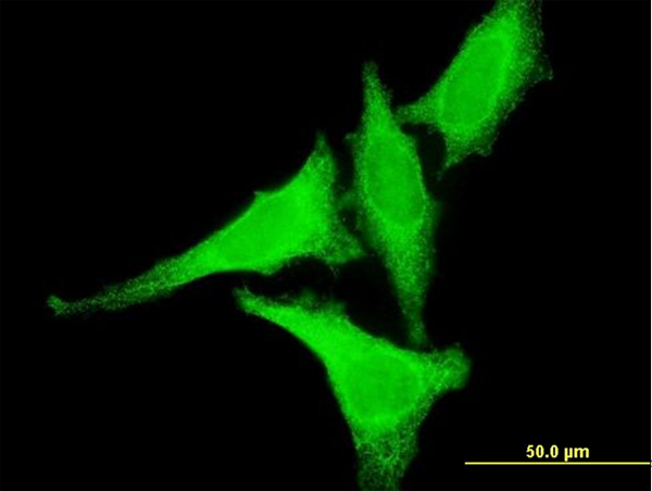 Immunofluorescence of monoclonal antibody to HSF2 on HeLa cell . [antibody concentration 10 ug/ml]