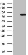 HEK293T cells were transfected with the pCMV6-ENTRY control (Left lane) or pCMV6-ENTRY HSF2 (Right lane) cDNA for 48 hrs and lysed. Equivalent amounts of cell lysates (5 ug per lane) were separated by SDS-PAGE and immunoblotted with anti-HSF2.