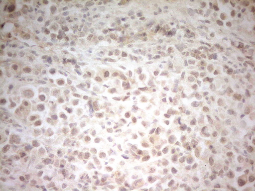 IHC of paraffin-embedded Human bladder tissue using anti-HSF2 mouse monoclonal antibody. (Heat-induced epitope retrieval by 1 mM EDTA in 10mM Tris, pH8.5, 120°C for 3min).