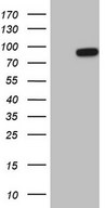 HEK293T cells were transfected with the pCMV6-ENTRY control (Left lane) or pCMV6-ENTRY HSF2 (Right lane) cDNA for 48 hrs and lysed. Equivalent amounts of cell lysates (5 ug per lane) were separated by SDS-PAGE and immunoblotted with anti-HSF2.