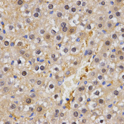 Immunohistochemistry of paraffin-embedded rat liver tissue using HSF2 antibody at dilution of 1:200 (x400 lens).