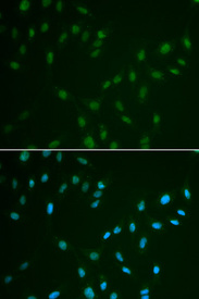Immunofluorescence analysis of A549 cell using HSF2 antibody. Blue: DAPI for nuclear staining.
