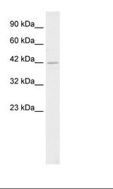 Jurkat Cell Lysate