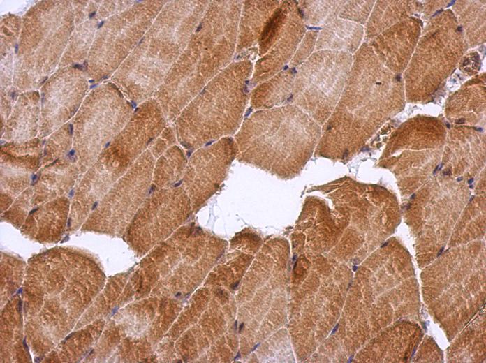 IHC of paraffin-embedded Muscle, using HSF2BP antibody at 1:500 dilution.