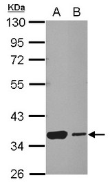 Sample (30 ug of whole cell lysate) A: NT2D1 B: SK-N-SH 10% SDS PAGE HSF2BP antibody diluted at 1:1000