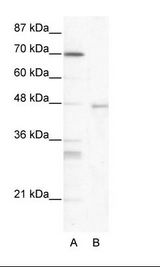 A: Marker, B: HepG2 Cell Lysate