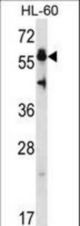 HSF4 Antibody western blot of HL-60 cell line lysates (35 ug/lane). The HSF4 antibody detected the HSF4 protein (arrow).