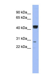 HSFY1 antibody LS-C110432 Western blot of COLO205 cell lysate.