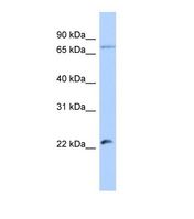 Western blot of Human Jurkat. HSFY2 antibody dilution 1.0 ug/ml.