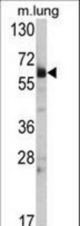 Western blot of Hsp 60 Antibody in mouse lung tissue lysates (35 ug/lane). Hsp (arrow) was detected using the purified antibody.