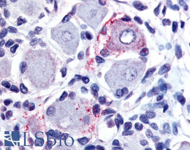 Anti-GPR149 antibody LS-A5102 IHC of human spinal cord, dorsal root ganglion. Immunohistochemistry of formalin-fixed, paraffin-embedded tissue after heat-induced antigen retrieval.