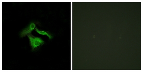 Immunofluorescence of HeLa cells, using GPR149 Antibody. The picture on the right is treated with the synthesized peptide.