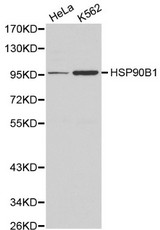 Western blot of HSP90B1 pAb in extracts from Hela and K562 cells.