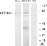 Western blot of extracts from HeLa/COLO205 cells, using GPR149 Antibody. The lane on the right is treated with the synthesized peptide.