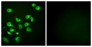 Immunofluorescence of HepG2 cells, using GRP94 Antibody. The picture on the right is treated with the synthesized peptide.