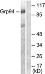 Western blot of extracts from SKOV3 cells, using GRP94 Antibody. The lane on the right is treated with the synthesized peptide.