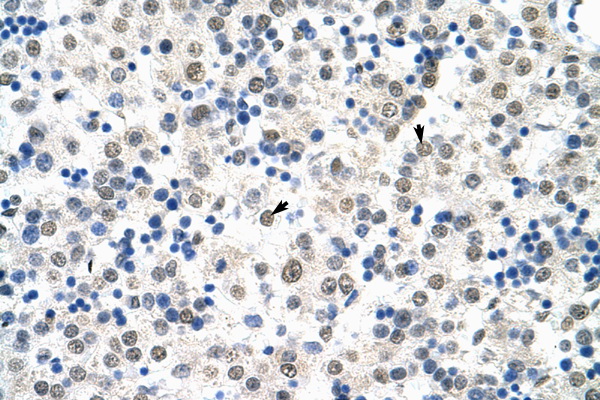 HSP90B1 / GRP94 antibody LS-C31586 IHC of formalin-fixed, paraffin-embedded human Liver. Positive label: Hepatocytes indicated with arrows. Antibody concentration 4-8 ug/ml. Magnification 400X.