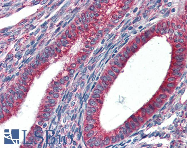 Anti-HSP90B1 / GRP94 antibody IHC of human uterus. Immunohistochemistry of formalin-fixed, paraffin-embedded tissue after heat-induced antigen retrieval. Antibody LS-B3243 concentration 5 ug/ml.