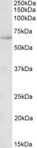 HSPA13 antibody (0.1 ug/ml) staining of Human Uterus lysate (35 ug protein in RIPA buffer). Primary incubation was 1 hour. Detected by chemiluminescence.