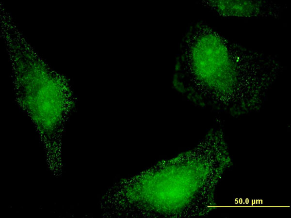 Immunofluorescence of monoclonal antibody to HSPA13 on HeLa cell . [antibody concentration 10 ug/ml]