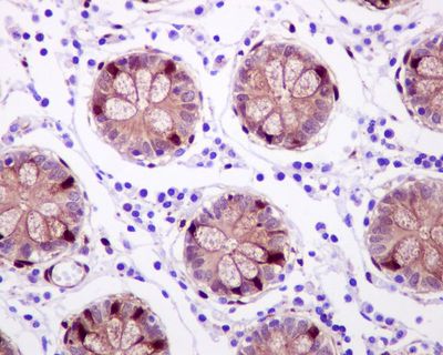 IHC of paraffin-embedded human colon tissue using anti-HSPA2 antibody.