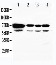 WB of HSPA2 antibody. All lanes: Anti-HSPA2 at 0.5ug/ml. Lane 1: Rat Testis Tissue Lysate at 40ug. Lane 2: A549 Whole Cell Lysate at 40ug. Lane 3: MCF-7 Whole Cell Lysate at 40ug. Lane 4: HELA Whole Cell Lysate at 40ug. Predicted bind size: 70KD. Observed bind size: 70KD.