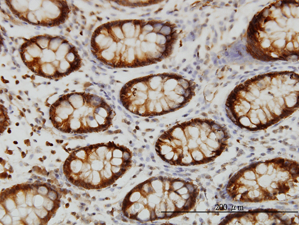 Immunoperoxidase of monoclonal antibody to HSPA2 on formalin-fixed paraffin-embedded human colon. [antibody concentration 1 ug/ml]