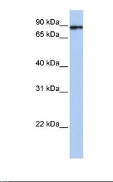 Fetal brain lysate. Antibody concentration: 1.0 ug/ml. Gel concentration: 12%.