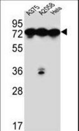 HSPA5 Antibody western blot of A375,A2058,HeLa cell line lysates (35 ug/lane). The HSPA5 antibody detected the HSPA5 protein (arrow).