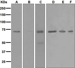Western blot analysis on (A) HeLa treated with 44 degrees C heat, (B) HeLa, (C) HT-1080, (D) MCF-7, (E) A431, and (F) Jurkat cell lysates using anti-HSPA6 antibody.
