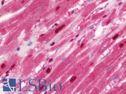 Anti-HSPA6 antibody IHC staining of human heart. Immunohistochemistry of formalin-fixed, paraffin-embedded tissue after heat-induced antigen retrieval. Antibody LS-B10826 concentration 7.5 ug/ml.