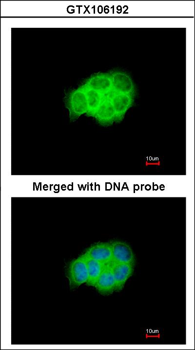 Immunofluorescence of paraformaldehyde-fixed A431 using HSPA6 antibody at 1:200 dilution.