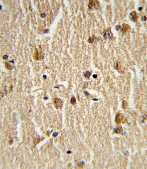 Formalin-fixed and paraffin-embedded human brain tissue reacted with HSPA8 Antibody , which was peroxidase-conjugated to the secondary antibody, followed by DAB staining. This data demonstrates the use of this antibody for immunohistochemistry; clinical relevance has not been evaluated.
